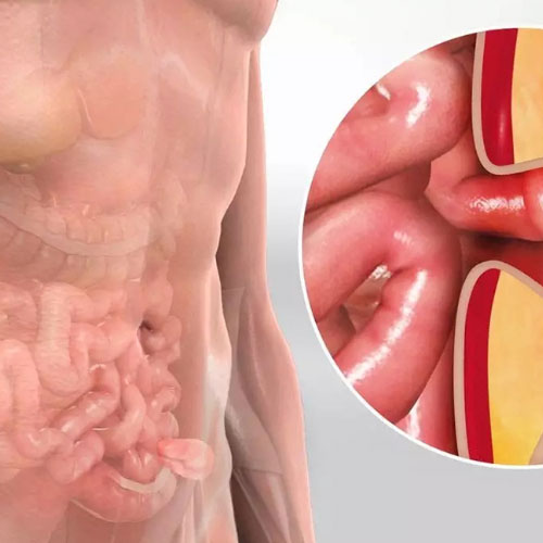 clinica de gastroenterologia